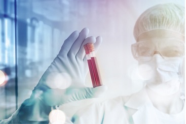 QuantiFERON tuberculosis test