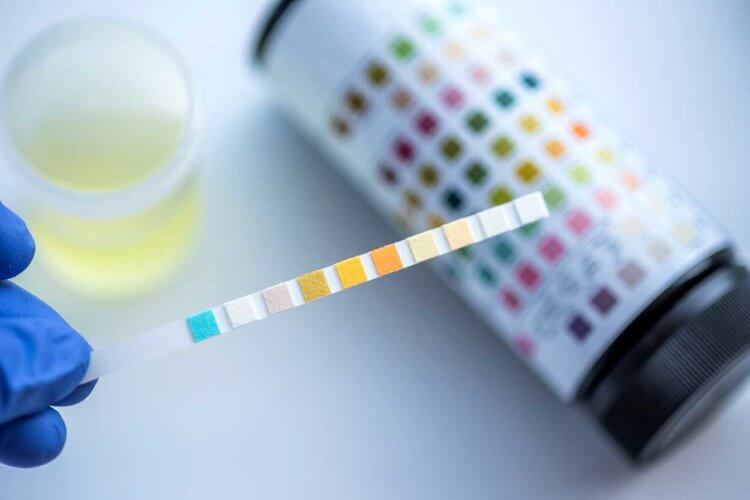 1 x Drug Test Kit 5 in 1 Urine Test