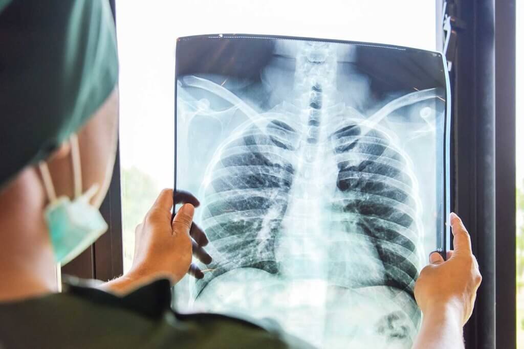 X-ray Services | Mobile Health | Employee Health Screening
