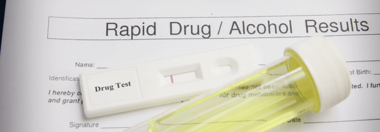 Urine-based rapid drug and alcohol test | NYC Employee Rapid Drug Testing