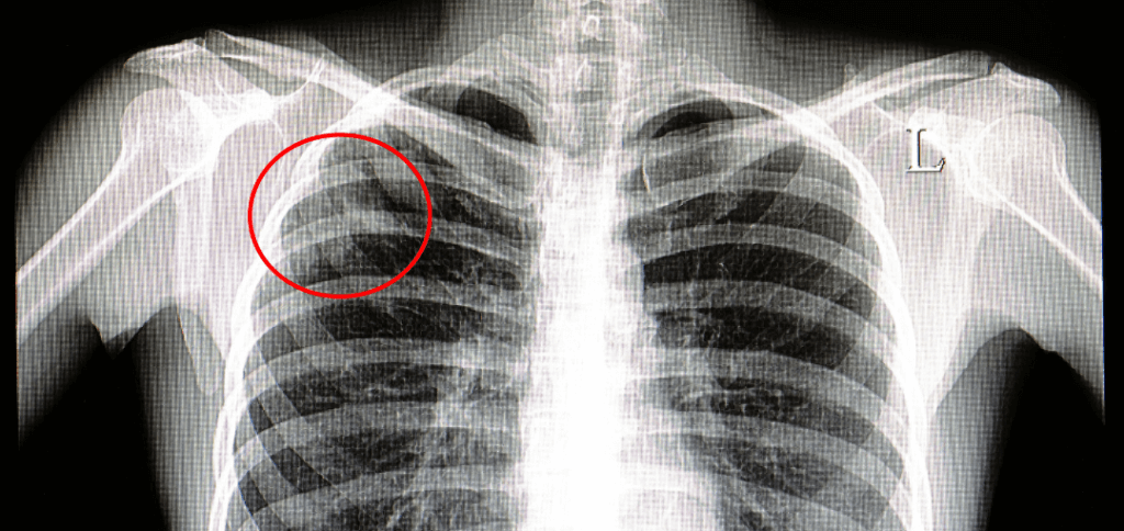 Comprehensive TB Testing for Healthcare Workers in NYC | Mobile Health | Employee Screening | Occupational Health
