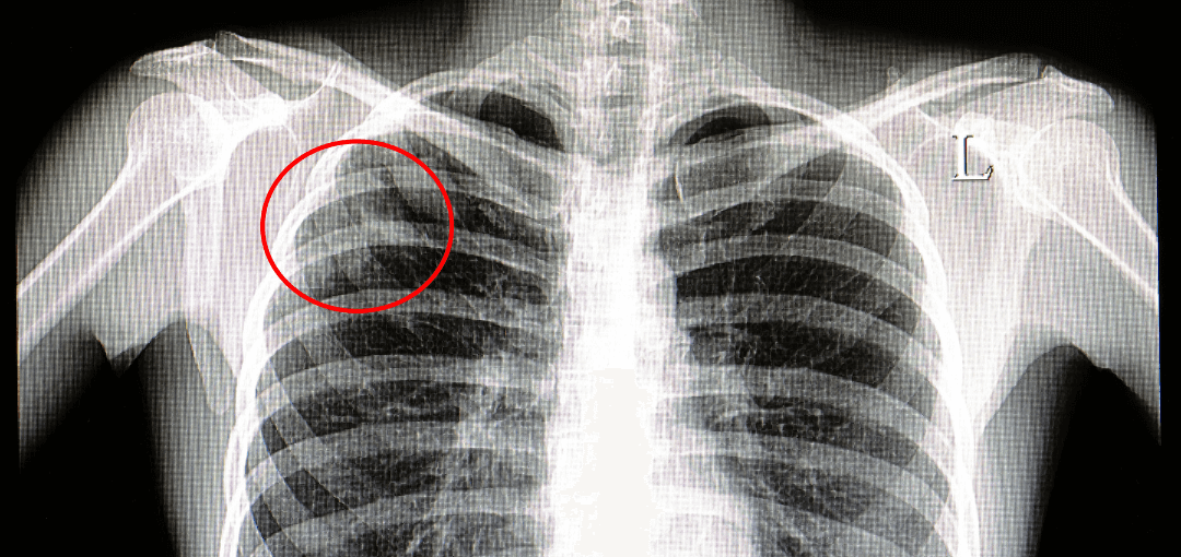 いいネット通販 - 全国送料無料でお届けします Comprehensive TB NYC in Workers Healthcare for Testing 健康・医学