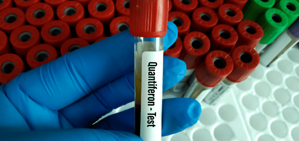 TB Testing Compliance in NYC: Ensuring Safety in Jails and Casinos | Mobile Health | Employee TB Testing